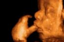 भ्रूण का फोटो, पेट का फोटो, अल्ट्रासाउंड और बच्चे के विकास के बारे में वीडियो