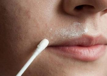 As melhores maneiras de remover permanentemente os pelos do lábio superior