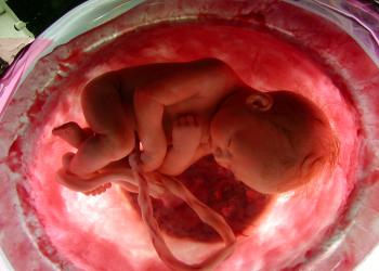 Cum se sparge apa înainte de naștere Testele lichidului amniotic în timpul sarcinii