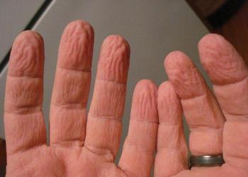 Por que a pele dos nossos dedos enruga quando tomamos banho?